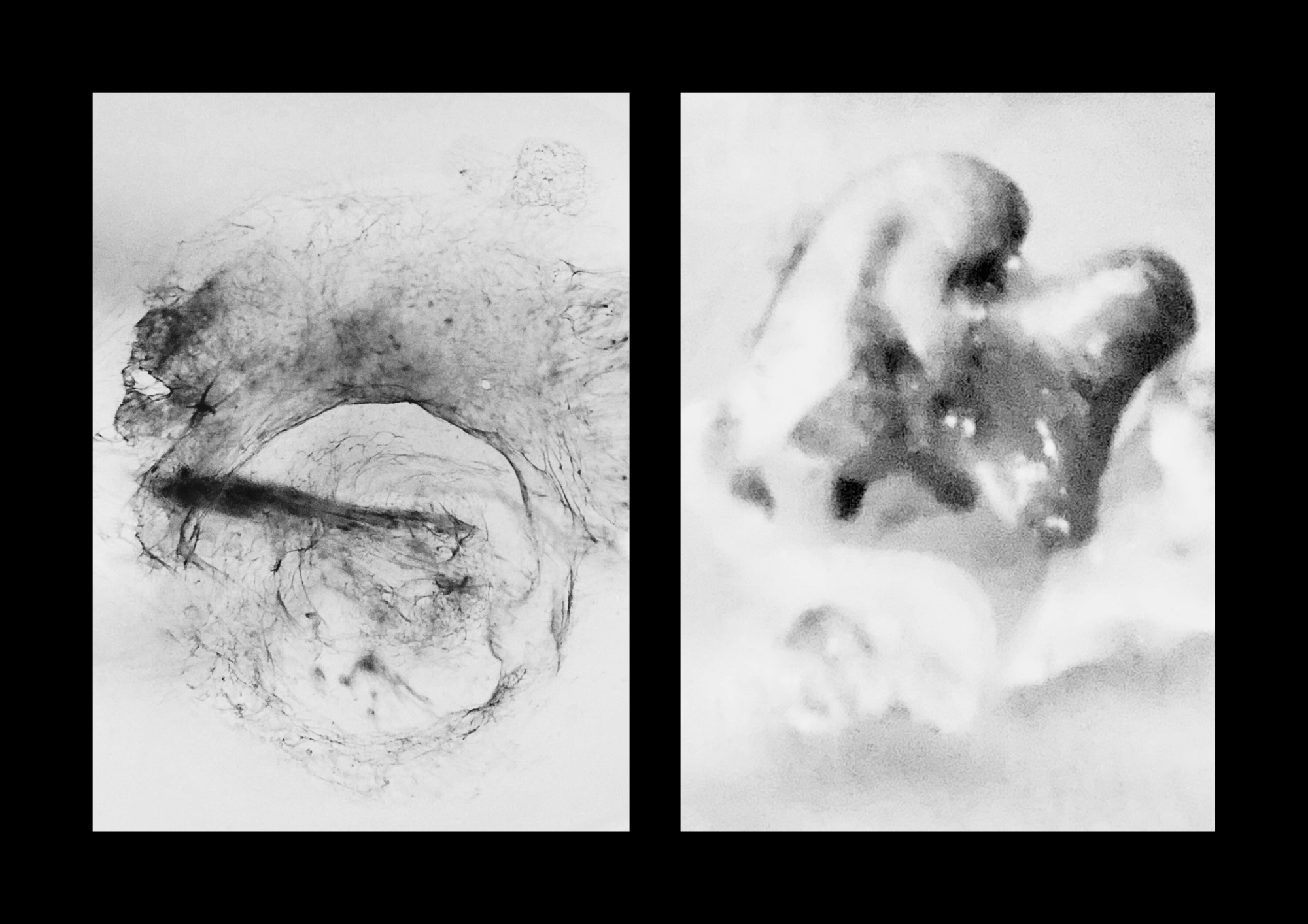 two black-and-white photographs of the same height arranged on a black background. the photograph on the left is of swirling blood that resembles a wild beast jumping over a log. the photograph on the right is of zoomed-in teeth that resemble lovers in embrace.